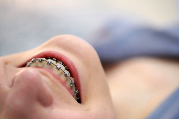 smiling girl with braces close up M3NX4GV