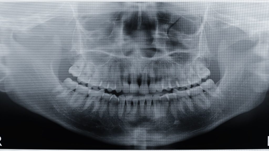 intraoral dental imaging