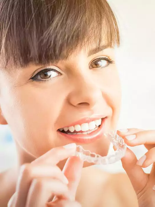 Invisalign Aligners