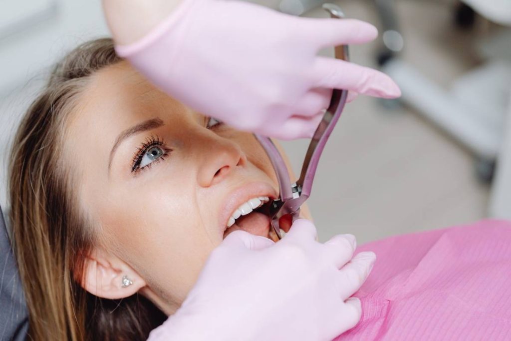 Dental extractions